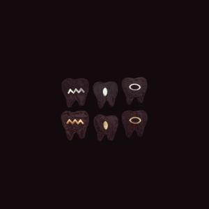 Joyería dental Formas