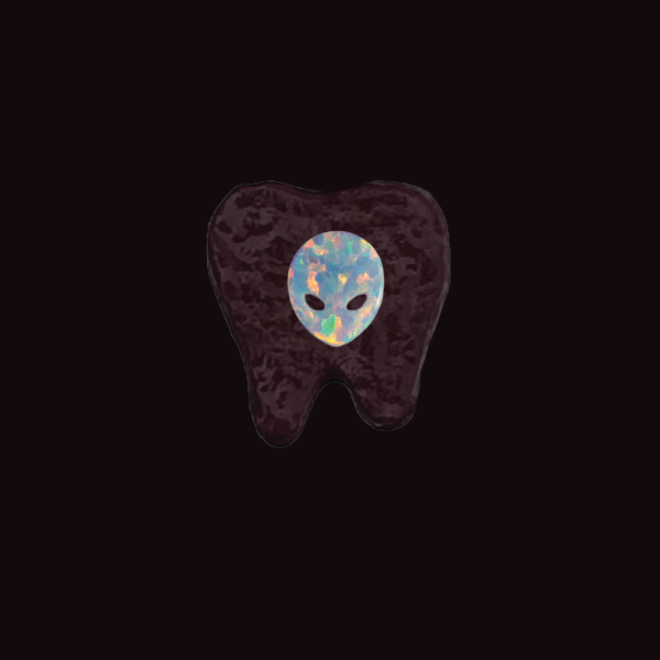 Joyería dental Ópalo - Image 4