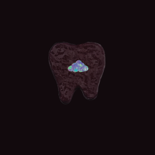 Joyería dental Ópalo - Image 15