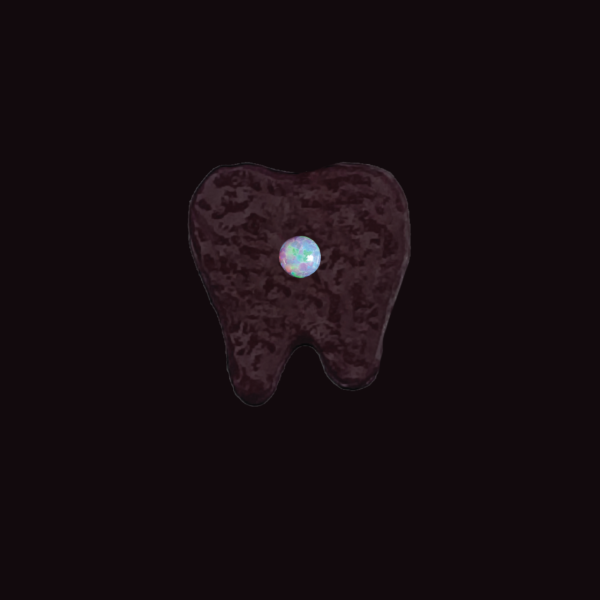 Joyería dental Ópalo - Image 16