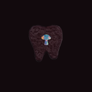 Joyería dental Ópalo