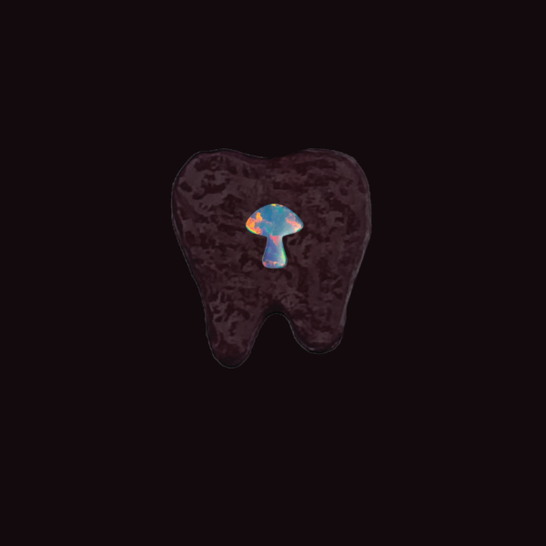 Joyería dental Ópalo - Image 2